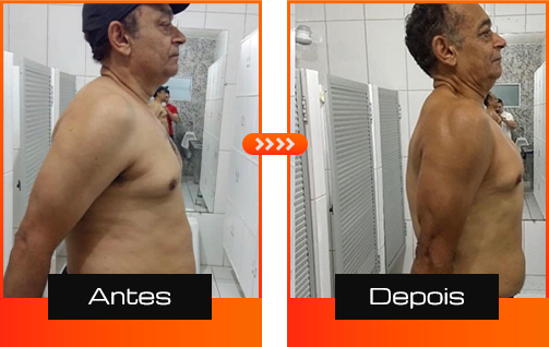 Antes e Depois